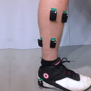 EMG investigation whether ankle taping has an effect on athletic performance and muscle activity in basketball players.