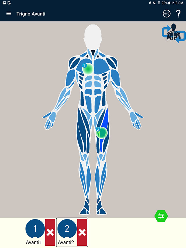 Anatomical muscle display