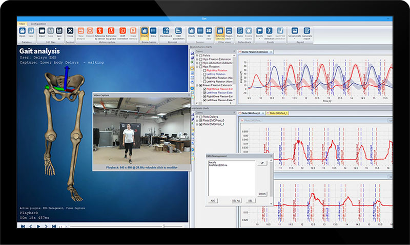 Kinematic Analysis